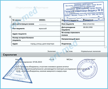 Купить тест на антитела к вирусу кори Купить справку тест на антитела к вирусу кори в Одинцово официально